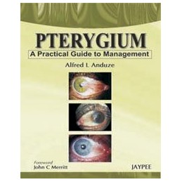 Pterygium - A Practical...