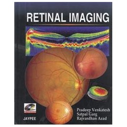 Retinal Imaging