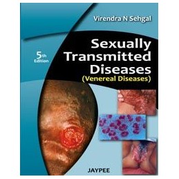 Sexually Transmitted Diseases (Venereal Diseases)