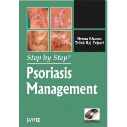 Step by Step: Psoriasis...