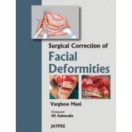 Surgical Correction of...