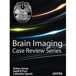 Brain Imaging: Case Review...