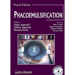 Phacoemulsification, Fourth Edition