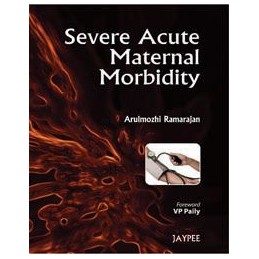 Severe Acute Maternal...