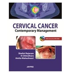 Cervical Cancer:...