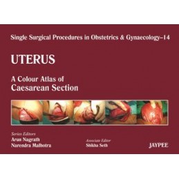 Single Surgical Procedures in Obstetrics and Gynaecology - Volume 14 - Uterus: A Colour Atlas of Caesarean Section