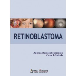 Retinoblastoma