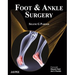 Foot and Ankle Surgery