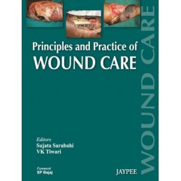 Principles and Practice Of Wound Care