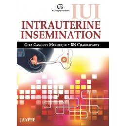 IUI Intrauterine Insemination