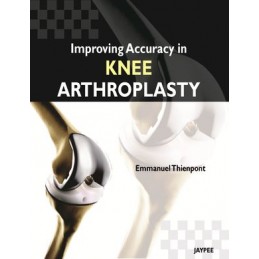 Improving Accuracy in Knee...