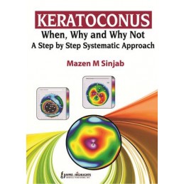 Keratoconus: When, Why and Why Not: A Step by Step Systematic Approach