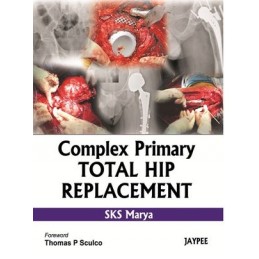 Complex Primary Total Hip...