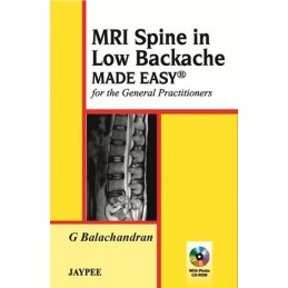 MRI Spine in Low Backache...