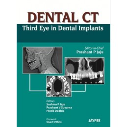 Dental CT Third Eye in...