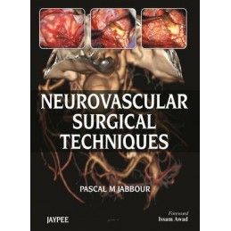 Neurovascular Surgical...