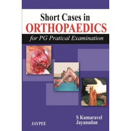 Short Cases in Orthopaedics