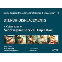 Single Surgical Procedures in Obstetrics and Gynaecology - Volume 16 - UTERUS - DISPLACEMENTS: A Colour Atlas of Supravaginal Ce