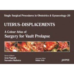 Single Surgical Procedures in Obstetrics and Gynaecology - Volume 20 - UTERUS - DISPLACEMENTS: A Colour Atlas of Surgery for Vau