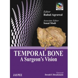 Temporal Bone: A Surgeon's...