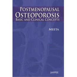 Post-Menopausal Osteoporosis