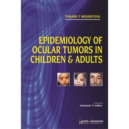 Epidemiology of Ocular...