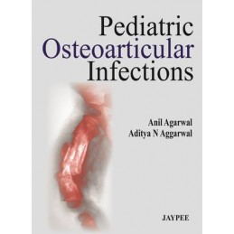 Pediatric Osteoarticular Infections