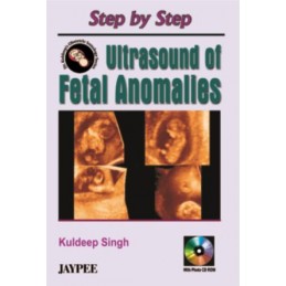 Step by Step Ultrasound of Fetal Anomalies