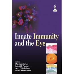 Innate Immunity and the Eye