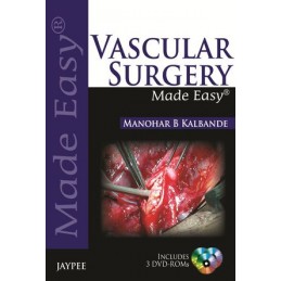 Vascular Surgery Made Easy