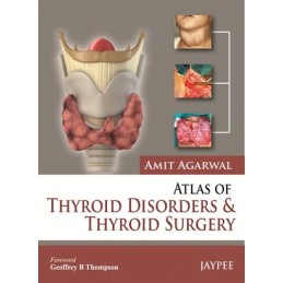 Atlas of Thyroid Disorders...