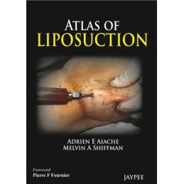 Atlas of Liposuction