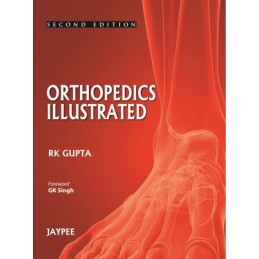 Orthopedics Illustrated