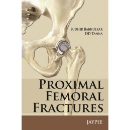 Proximal Femoral Fractures