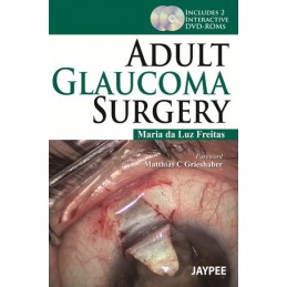 Adult Glaucoma Surgery