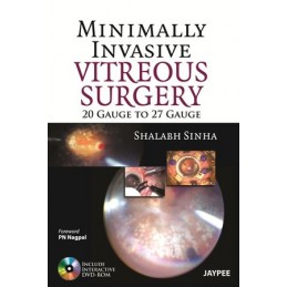 Minimally Invasive Vitreous...