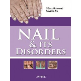 Nail & Its Disorders