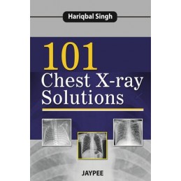 101 Chest X-Ray Solutions