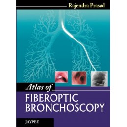 Atlas of Fiberoptic Bronchoscopy