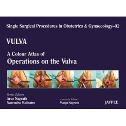 Single Surgical Procedures in Obstetrics and Gynaecology - Volume 2 - VULVA - A Colour Atlas of Operations on the Vulva
