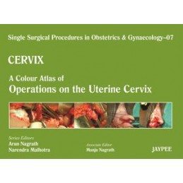 Single Surgical Procedures in Obstetrics and Gynaecology - Volume 7 - CERVIX - A Colour Atlas of Operations on the Uterine Cervi