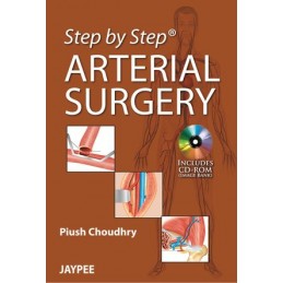 Step by Step: Arterial Surgery