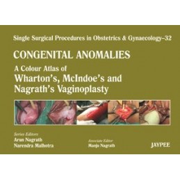 Single Surgical Procedures in Obstetrics and Gynaecology: Volume 32: Congenital Anomalies: A Colour Atlas of Wharton's, McIndoe'