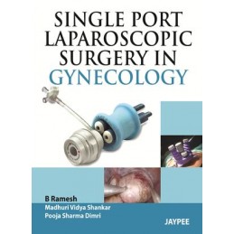 Single Port Laparoscopic...