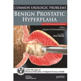 Common Urologic Problems:...