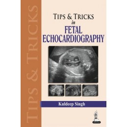 Tips & Tricks in Fetal Echocardiography