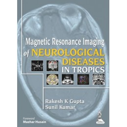 Magnetic Resonance Imaging...