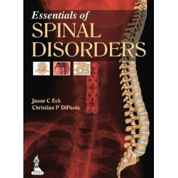 Essentials of Spinal Disorders