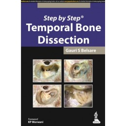 Step by Step: Temporal Bone...