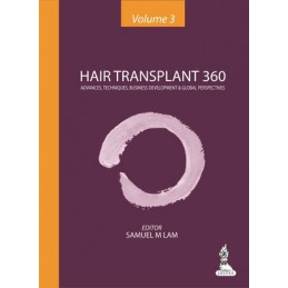 Hair Transplant 360 -...